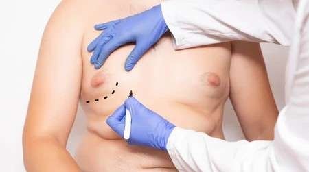 doktor-plastic-surgeon-preparation-before-260nw-1482365021